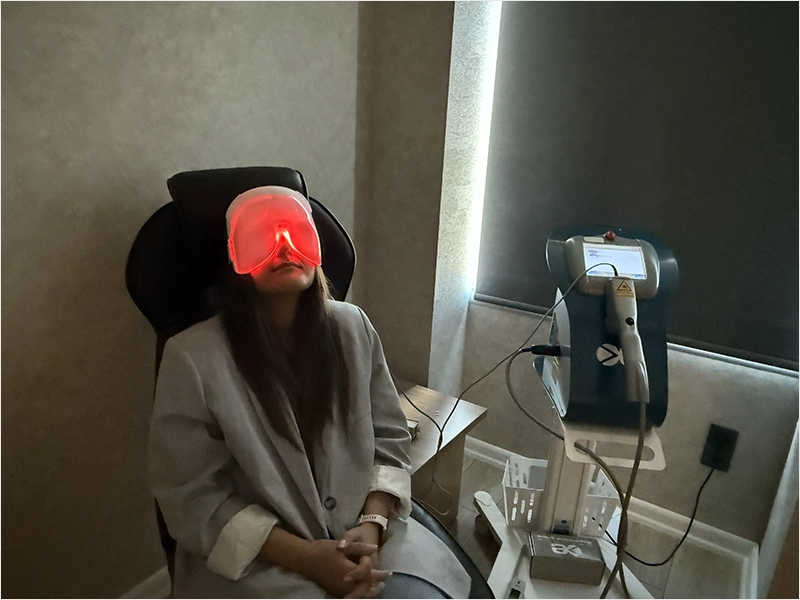 Kuru Gözde IPL Tedavisi